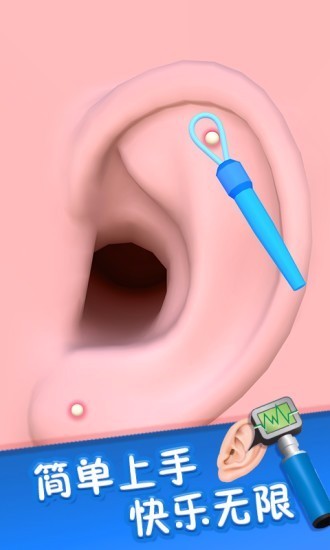 你是来掏耳屎的吧国际服版截图2